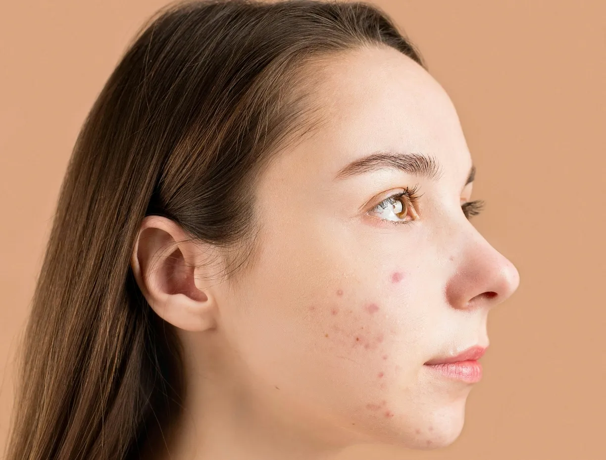 त्वचा (Skin) की समस्या होने के कारण